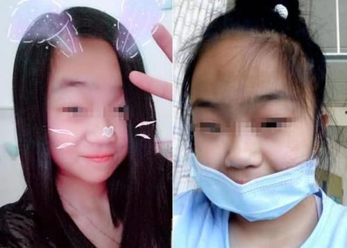 大帅哥|这5种孩子会越长越丑,长大也难逃开“变丑”结局,你家娃中了吗