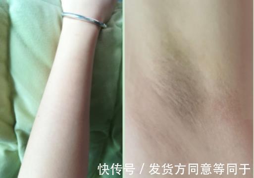 拆君|评测 ｜ 历时30天，真人实测娜蜜丝冰钻6.5高能量光子脱毛仪