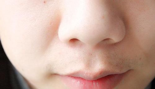 鼻子上总能挤出很多白点,到底是什么送你妙招,鼻子变干净