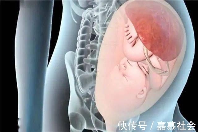 产妇|产道那么小胎儿到底咋出来的?看完这组图泪目了,女人太不容易了