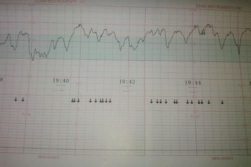 参照性|怀孕反应不一样,胎儿性别也不一样?别不信,这些差异存在参照性