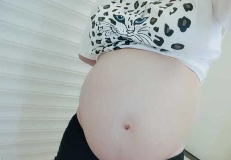 妊娠|“四维彩超通过了,为何胎儿还会畸形”孕妈要多留心眼