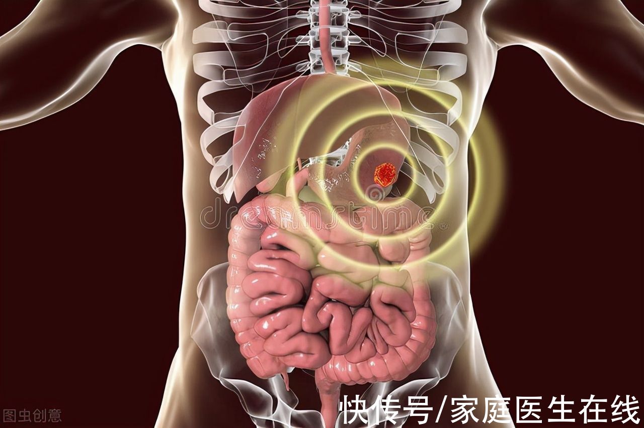 恶性肿瘤|消化道肿瘤占全体肿瘤40%，一半国人是吃出来的，饮食原则来了