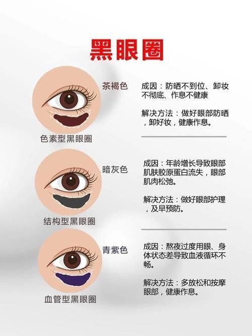 眼部|黑眼圈 、眼袋、 眼角纹、 脂肪粒，它们的形成原因你知道吗？