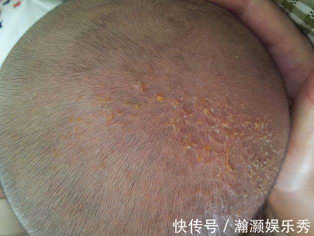 带娃|妈妈偷懒的带娃方式,差点把2个月宝宝差点弄成脑瘫,医生:无知