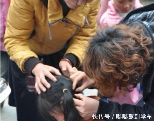 小女儿总说头皮痒，妈妈用手电筒一照，身上的鸡皮疙瘩都起来了！