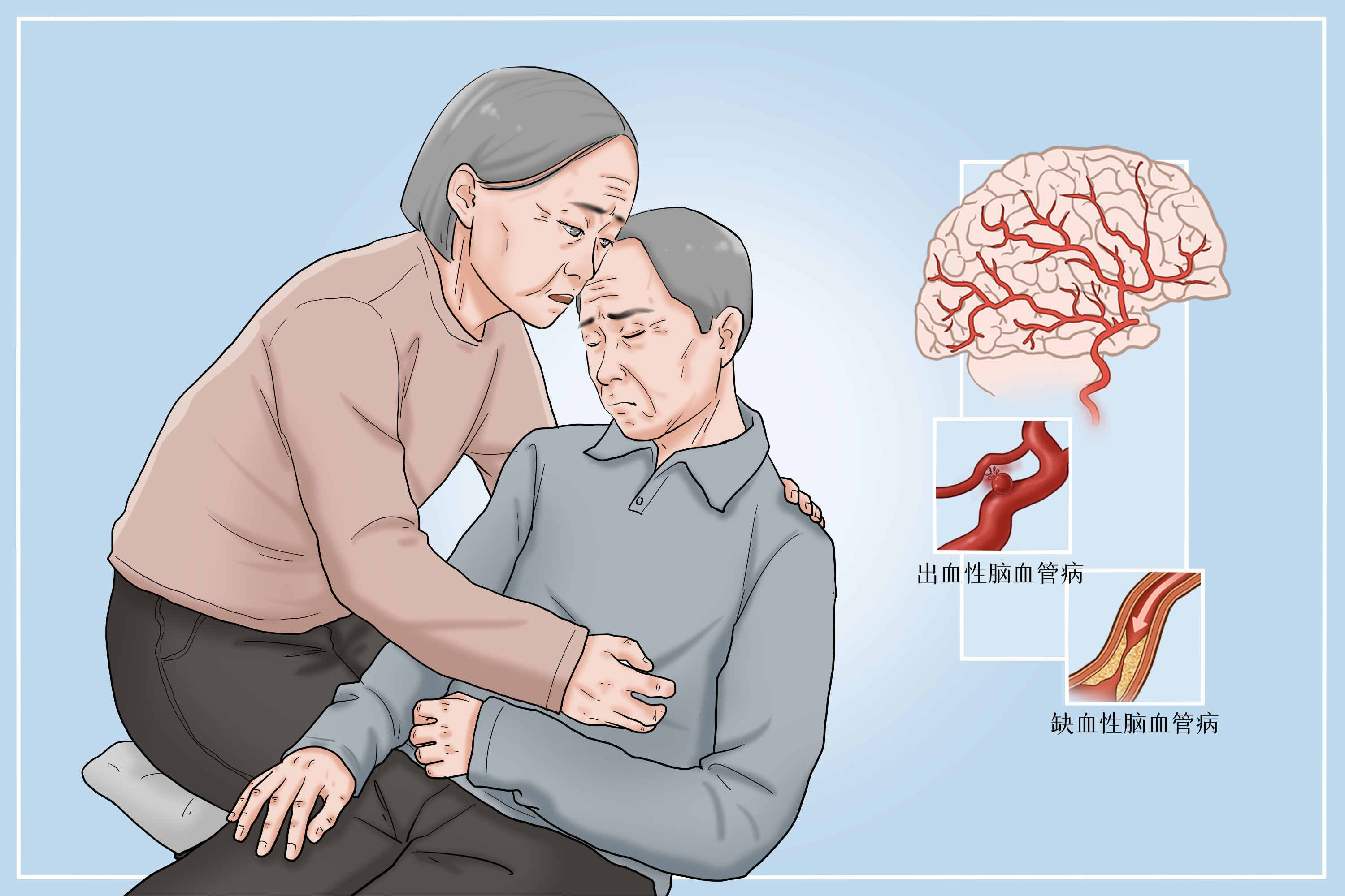 中风|大脑突然出现“断片”？脑卒中不是老年人“专利”，中风信号需识别