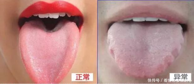  部位|体内湿邪重，3个部位会发出''信号''，做好4件事，逼出体内湿气