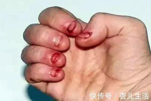 指甲|从小“啃指甲”的孩子,长大后大多逃不开两种结局,家长要早制止