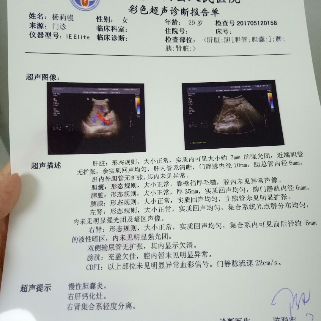 胎宝宝|做B超时别再问医生胎宝宝性别了,是男是女,自己看单子也能分辨