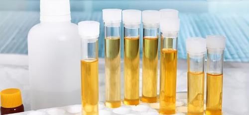 肾小球滤过率|去年体检，今年确诊尿毒症！全因没看懂那张检查报告单