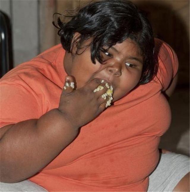 孩子|那个1岁体重高达45斤的孩子,太能吃父母担心养不起,如今怎样了