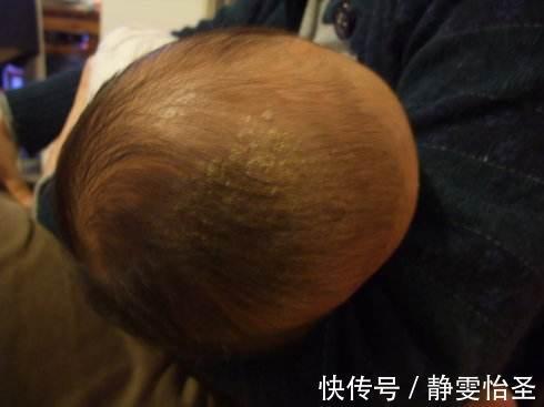 父母|婴幼儿有4个部位,亲妈也不能动,做父母的可要管住自己的手