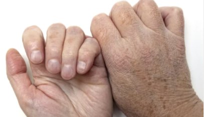 肝郁脾虚|手是疾病放大镜，这些问题要警惕！每天这样拍手，给内脏按按摩