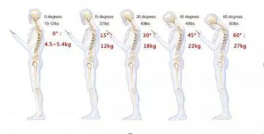 锻炼|这些小动作可以避免颈椎病,骨伤科教授白志强主任讲述
