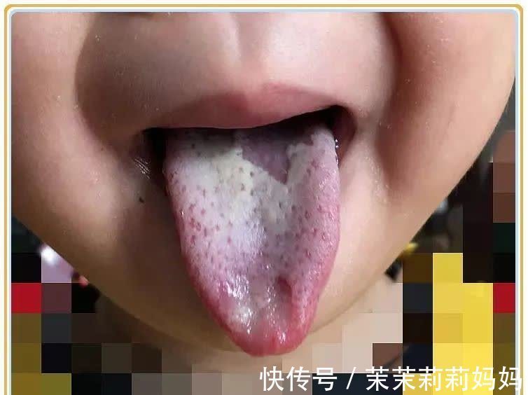 包包|孩子眼皮上长包,不痛不痒,一直消不下去?说明这里出了问题!