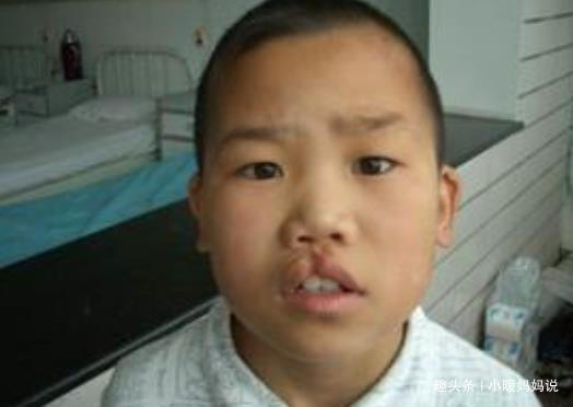 准妈妈们|孕妇十月怀胎,剖腹产2小时竟生出了“怪胎”,医生恭喜你