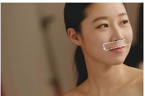 不到50岁就老成大妈？小拉皮术后6个月轻松实现逆生长！