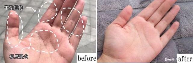 补水|日本变态手霜,效果堪比“换皮”轻轻一抹,双手一夜重回婴儿肌