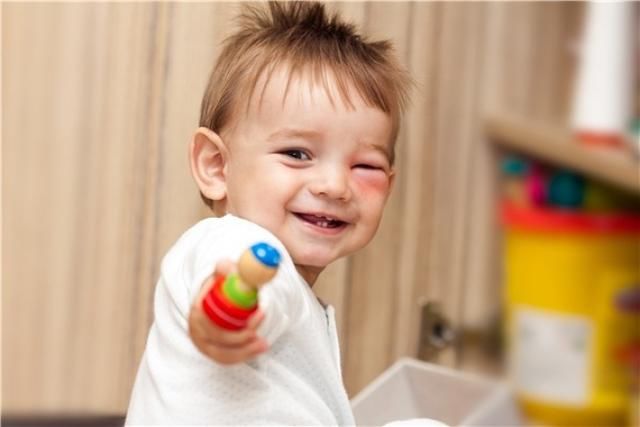 创面|15种意外伤害急救方法 为宝宝的安全保驾护航！