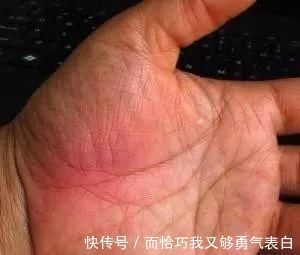 青筋|手掌上这块肉，一看就知道身体好不好！没事经常搓一搓，宣肺强心