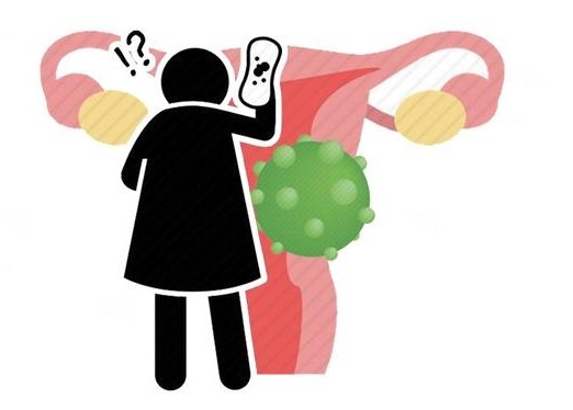 分泌物|宫颈癌一查就是晚期？其实身体早早给了暗示，只是大多数人不了解
