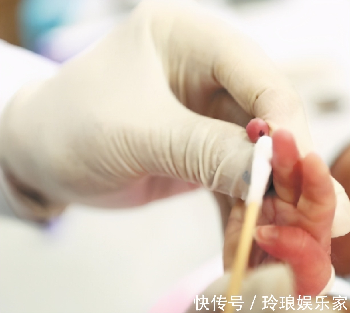 嵌合体|儿子DNA鉴定“叔叔”是亲爹，可老爸却是独生子，医生表示没错