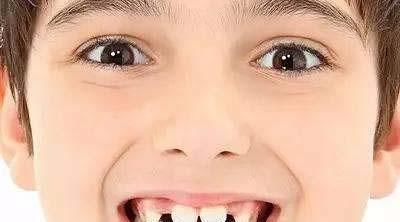 妈妈|15岁男孩长出“尖牙”,妈妈亲手摸过后吐槽:养了个“吸血鬼”