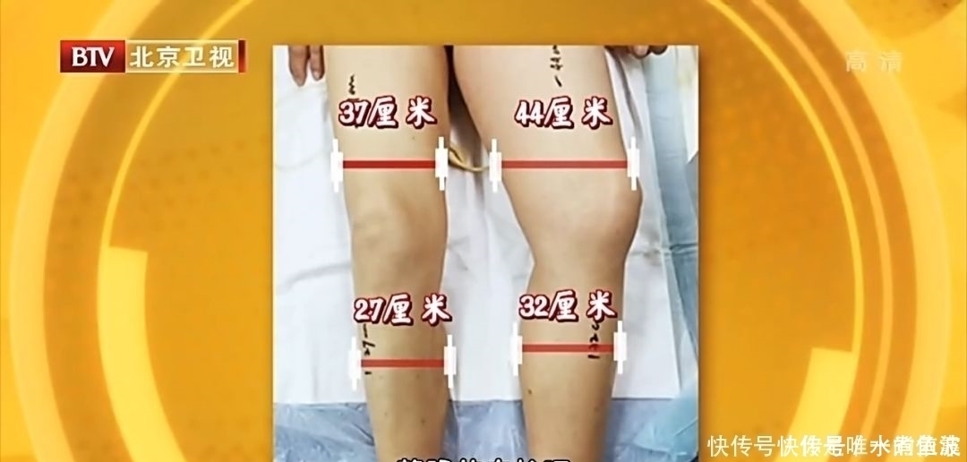 血流|脚上有个化血栓开关，打开它，清血管、防血栓！9种人最好常做！