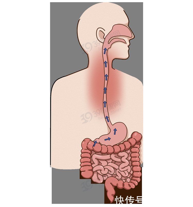 慢性咽炎|慢性咽炎总不好怎么办？这6味药要收好，肿痛、干痒可能就消失了