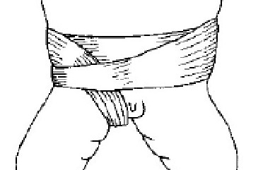 小儿疝气|小儿得了疝气怎么办