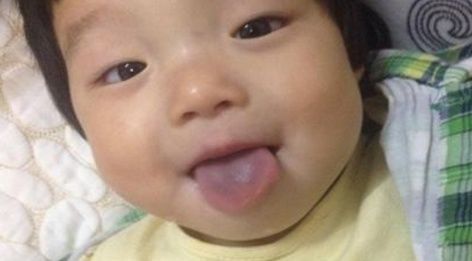 鸡内金|孩子积食再顽固,宝妈用2招,轻松去积食,孩子长大个