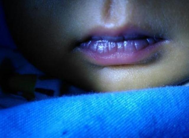 血管|血液粘稠的人,身体两处会发出信号,若没有,说明血管还不算太堵