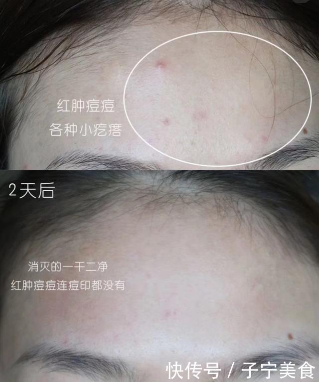 评测告诉你,这些产品祛痘淡印最有效