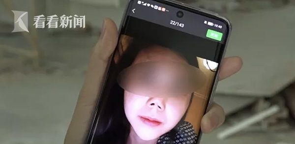 吴女士 美女变怪物?女子做手术整容 如今门都不敢出