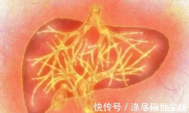 黄豆芽|失眠多梦，肝火旺？3种食物是肝脏“灭火器”，排肝毒，降肝火