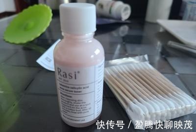 痘痘|天气越热、“痘痘”越多?3个原因+改善方法,瑕疵痘痘肌有救了