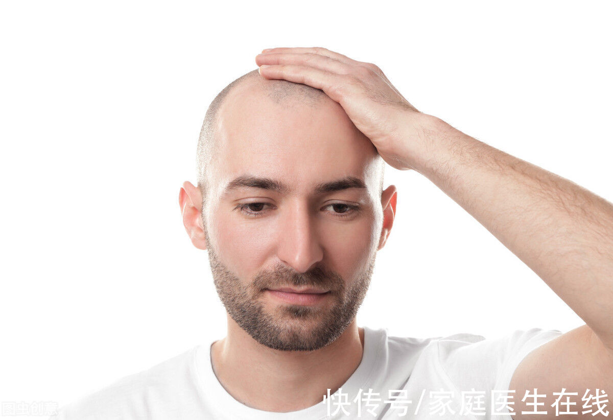 90后|90后男性已开始脱发？什么程度算是脱发？给你一份脱发解救策略