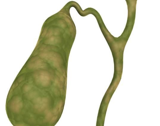 癌前病变|四个部位长息肉,最好及时做手术切除,久而久之可能发展成癌症!