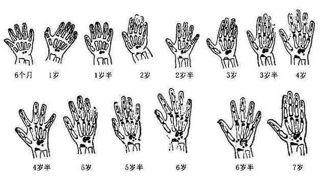 小丁|孩子身上三个部位“短”,将来可能不会长太高,家长要“早知道”