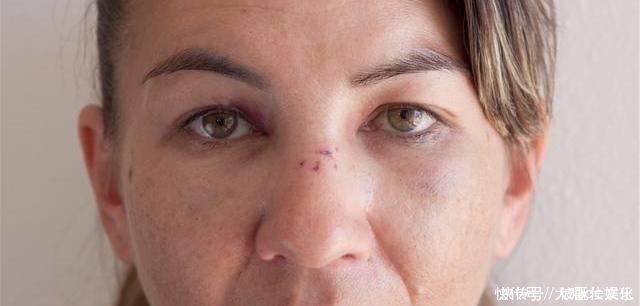 脾虚百病生脾有“三怕”,多吃“一果”,健脾祛湿一步到位