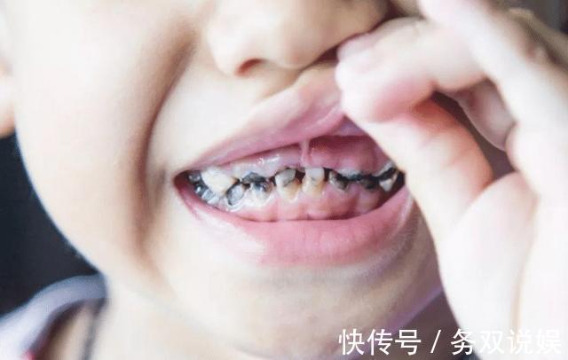 换牙|牙科医生提醒，孩子正在换牙的父母们，你们一直都做错了什么