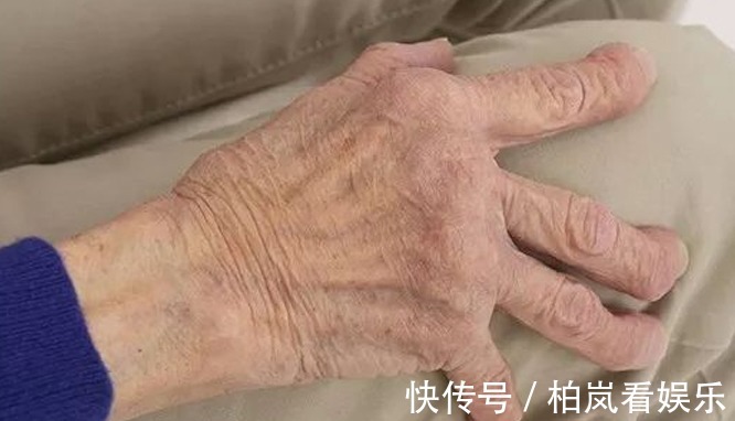 骨刺|5种病无法根治!忽悠能根治是骗你,莫轻信谣言,搞得人财两空!