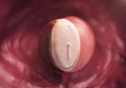 胎儿|胎儿在妈妈肚子里有“两怕”,孕早中晚期各不同,孕妈要分别注意