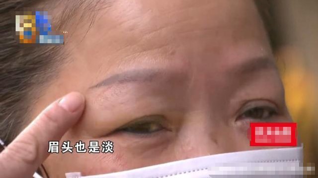 擦什么可以让纹眉褪色