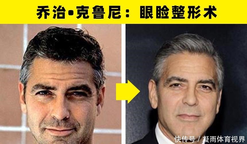 乔治·克鲁尼|大方承认自己做过整形手术的8名好莱坞明星