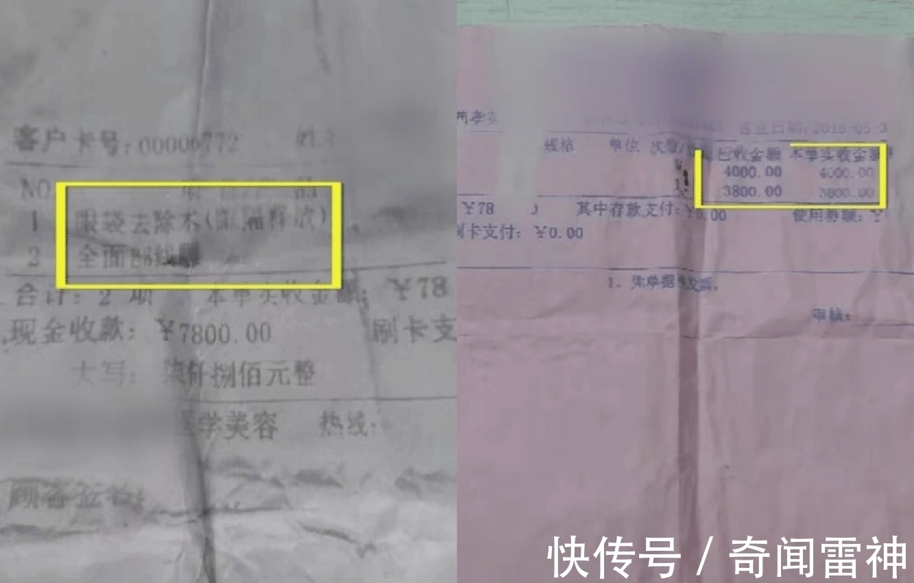 爱美之心 女子砍价2.6万做整容, 手术失败变“大妈”, 医院 效果也打折
