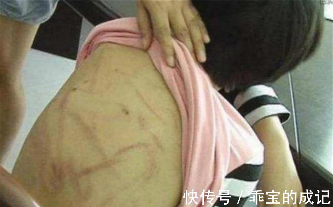 孩子|7岁女儿生病发烧,边哭边念叨着“洗衣机”,妈妈打开后“崩溃”