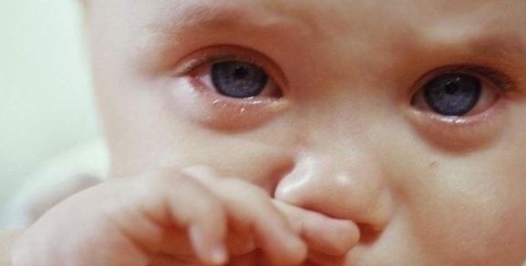 鼻子|如果宝宝脸上出现这3个情况,多半是脾胃不健康,父母要多观察哦