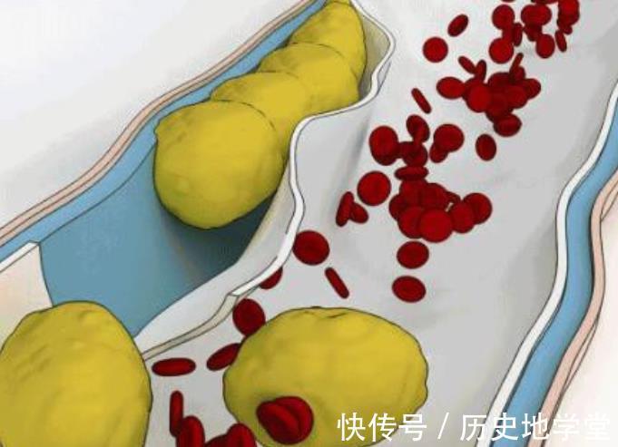 身体|经常吃豆腐乳，对身体好还是不好？爱吃豆腐乳的人，不妨了解下